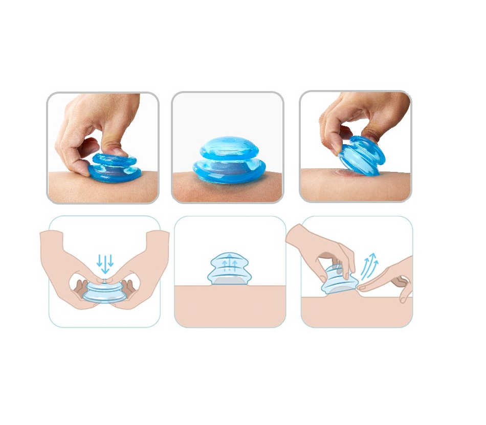 Professional Silicone Massage Cups – Cellulite Vacuum Cup Set (4 pcs)